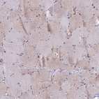 Immunohistochemical staining of human skeletal muscle shows weak cytoplasmic positivity in myocytes.