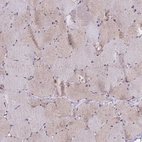 Immunohistochemical staining of human skeletal muscle shows weak cytoplasmic positivity in myocytes.