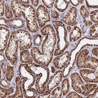 Anti-OR8S1 Antibody