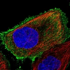Immunofluorescent staining of human cell line A-431 shows localization to plasma membrane.