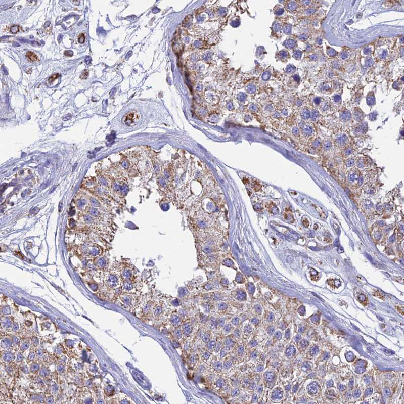 Anti-OR2W3 Antibody