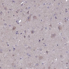 Immunohistochemical staining of human cerebral cortex shows weak positivity in neurons.