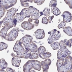 Immunohistochemical staining of human placenta shows moderate positivity in trophoblastic cells.