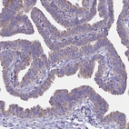 Immunohistochemical staining of human fallopian tube shows weak positivity in glandular cells.