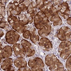 Anti-C1orf204 Antibody