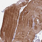 Immunohistochemical staining of human skeletal muscle shows strong cytoplasmic positivity in myocytes.