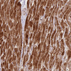 Anti-CFL2 Antibody