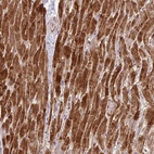Immunohistochemical staining of human heart muscle shows strong cytoplasmic positivity in cardiomyocytes.