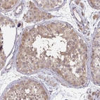 Immunohistochemical staining of human testis shows moderate cytoplasmic positivity in cells in seminiferous ducts.