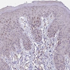 Immunohistochemical staining of human skin shows no cytoplasmic positivity in squamous epithelial cells as expected.