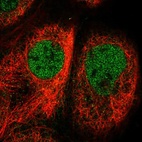 Anti-CFL2 Antibody