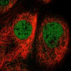 Immunofluorescent staining of human cell line A-431 shows localization to nucleoplasm.