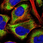 Immunofluorescent staining of human cell line U-2 OS shows localization to cytosol.