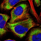 Immunofluorescent staining of human cell line U-2 OS shows localization to cytosol.