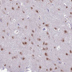 Anti-NOVA2 Antibody