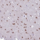 Immunohistochemical staining of human cerebral cortex shows moderate nuclear positivity in neuronal cells.