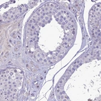 Immunohistochemical staining of human testis shows very weak nuclear positivity in cells in seminiferous ducts.