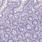 Immunohistochemical staining of human duodenum shows no nuclear positivity in glandular cells as expected.
