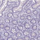 Immunohistochemical staining of human duodenum shows no nuclear positivity in glandular cells as expected.