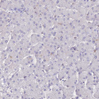 Immunohistochemical staining of human liver shows no nuclear positivity in hepatocytes as expected.
