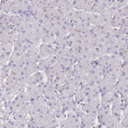 Anti-NOVA2 Antibody