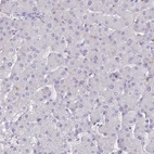 Immunohistochemical staining of human liver shows no nuclear positivity in hepatocytes as expected.