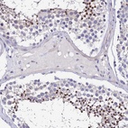 Anti-UBE2L3 Antibody