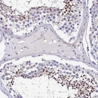 Anti-UBE2L3 Antibody