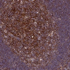 Immunohistochemical staining of human lymphoid tissues shows cytoplasmic positivity in germinal center cells.