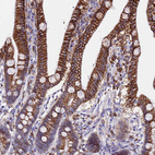 Immunohistochemical staining of human upper gastrointestinal shows strong membranous positivity in glandular cells.