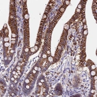 Immunohistochemical staining of human upper gastrointestinal shows strong membranous positivity in glandular cells.