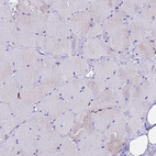 Immunohistochemical staining of human skeletal muscle shows negative to very weak positivity in myocytes.