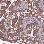 Anti-ARHGEF35 Antibody