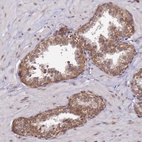 Anti-CCDC9 Antibody