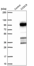 Western blot analysis in control (vector only transfected HEK293T lysate) and CCDC9 over-expression lysate (Co-expressed with a C-terminal myc-DDK tag (~3.1 kDa) in mammalian HEK293T cells, LY414450).