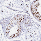 Immunohistochemical staining of human testis shows strong nuclear positivity in cells in seminiferous ducts.