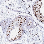 Immunohistochemical staining of human testis shows strong nuclear positivity in cells in seminiferous ducts.