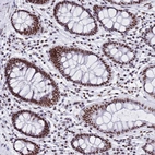 Immunohistochemical staining of human colon shows strong nuclear positivity in glandular cells and lymphoid cells.