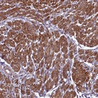 Anti-ZNF626 Antibody