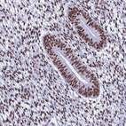 Anti-SNRPA1 Antibody