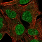 Immunofluorescent staining of human cell line SK-MEL-30 shows localization to nucleoplasm, nuclear membrane & vesicles.