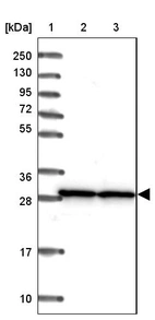 Lane 1: Marker [kDa] 250, 130, 95, 72, 55, 36, 28, 17, 10_br/_Lane 2: Human cell line RT-4_br/_Lane 3: Human cell line U-251MG sp