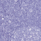 Immunohistochemical staining of human tonsil shows no positivity in non-germinal center cells as expected.