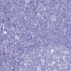Immunohistochemical staining of human tonsil shows no positivity in non-germinal center cells as expected.
