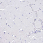 Immunohistochemical staining of human skeletal muscle shows no positivity in myocytes as expected.
