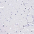 Immunohistochemical staining of human skeletal muscle shows no positivity in myocytes as expected.