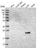 Western blot analysis in human cell line RT-4, human cell line U-251 MG, human plasma, human liver tissue and human tonsil tissue.
