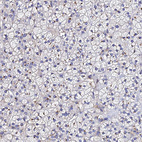 Anti-ADAMTSL2 Antibody