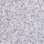 Anti-ADAMTSL2 Antibody