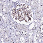 Immunohistochemical staining of human kidney shows moderate membranous positivity in cells in glomeruli.